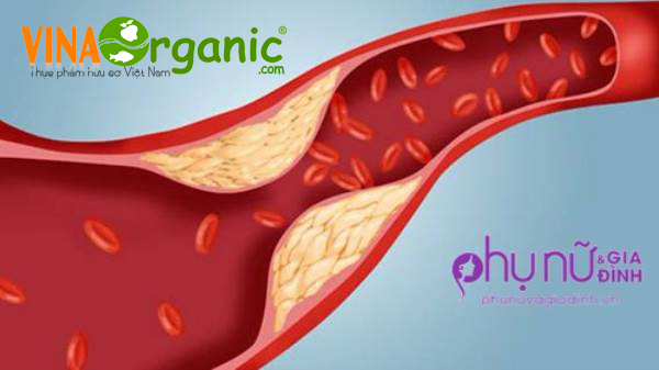giam-cholesterol-vinaorganic